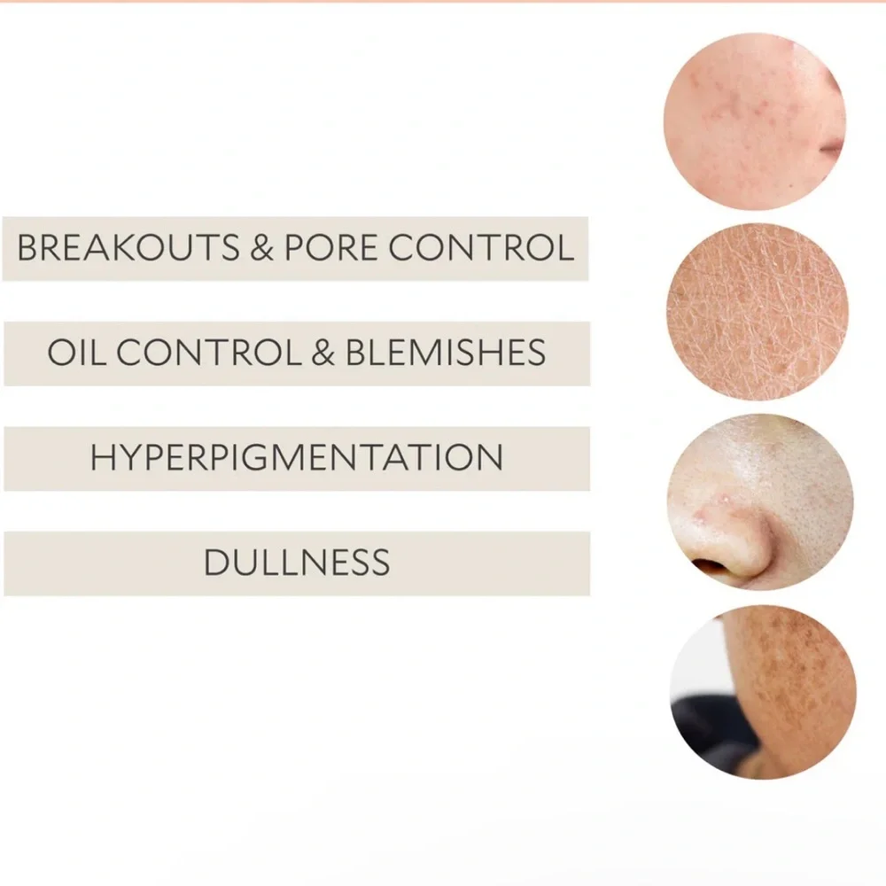 💦 SKIN&CO Truffle Therapy Essential Face Toner - 75ml